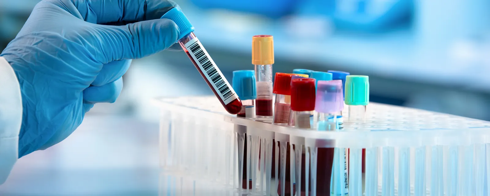 Diagnostic Lab Collecting Patient Samples.